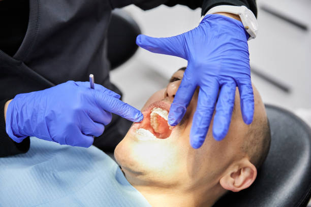 Trusted TX Emergency Dental Service Experts